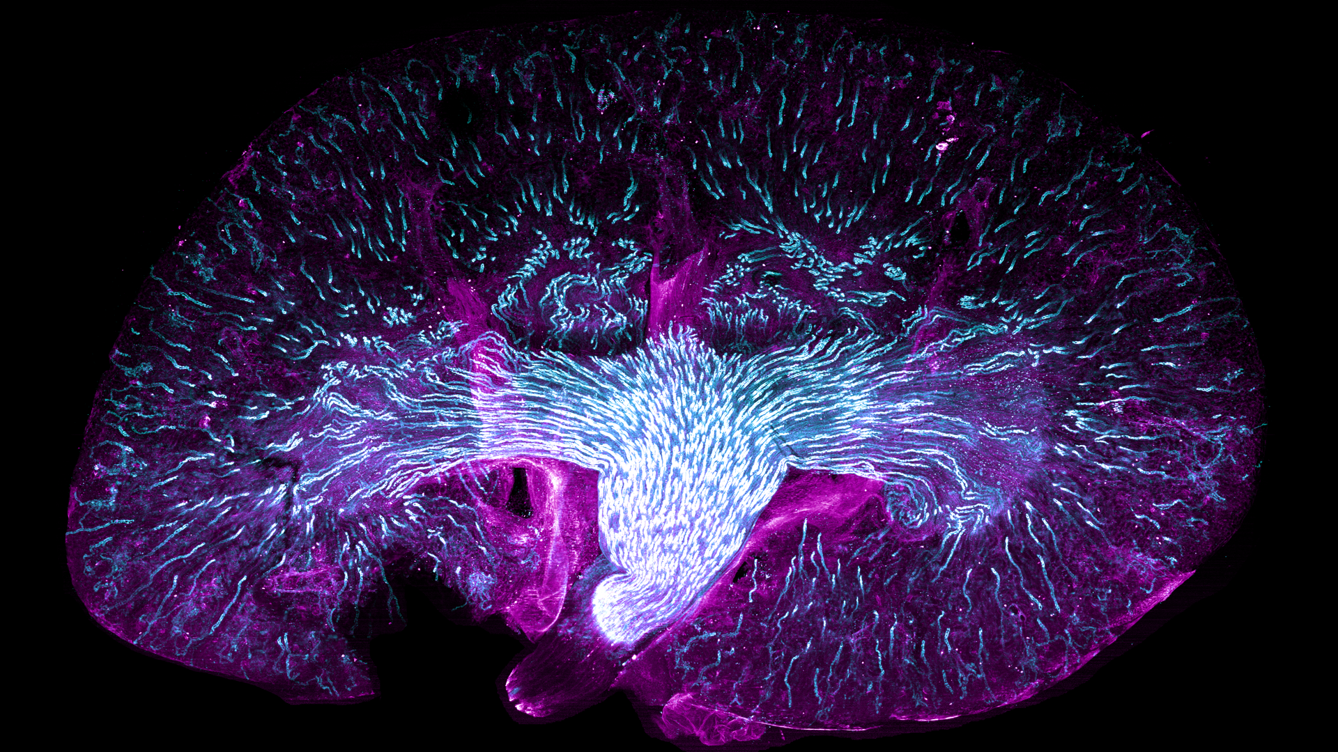 Mouse kidney cleared using the REPLICA protocol. Aquaporin 2 is shown in cyan and CD105 in magenta.